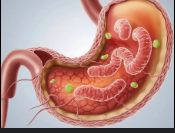 علاج جرثومة المعدة